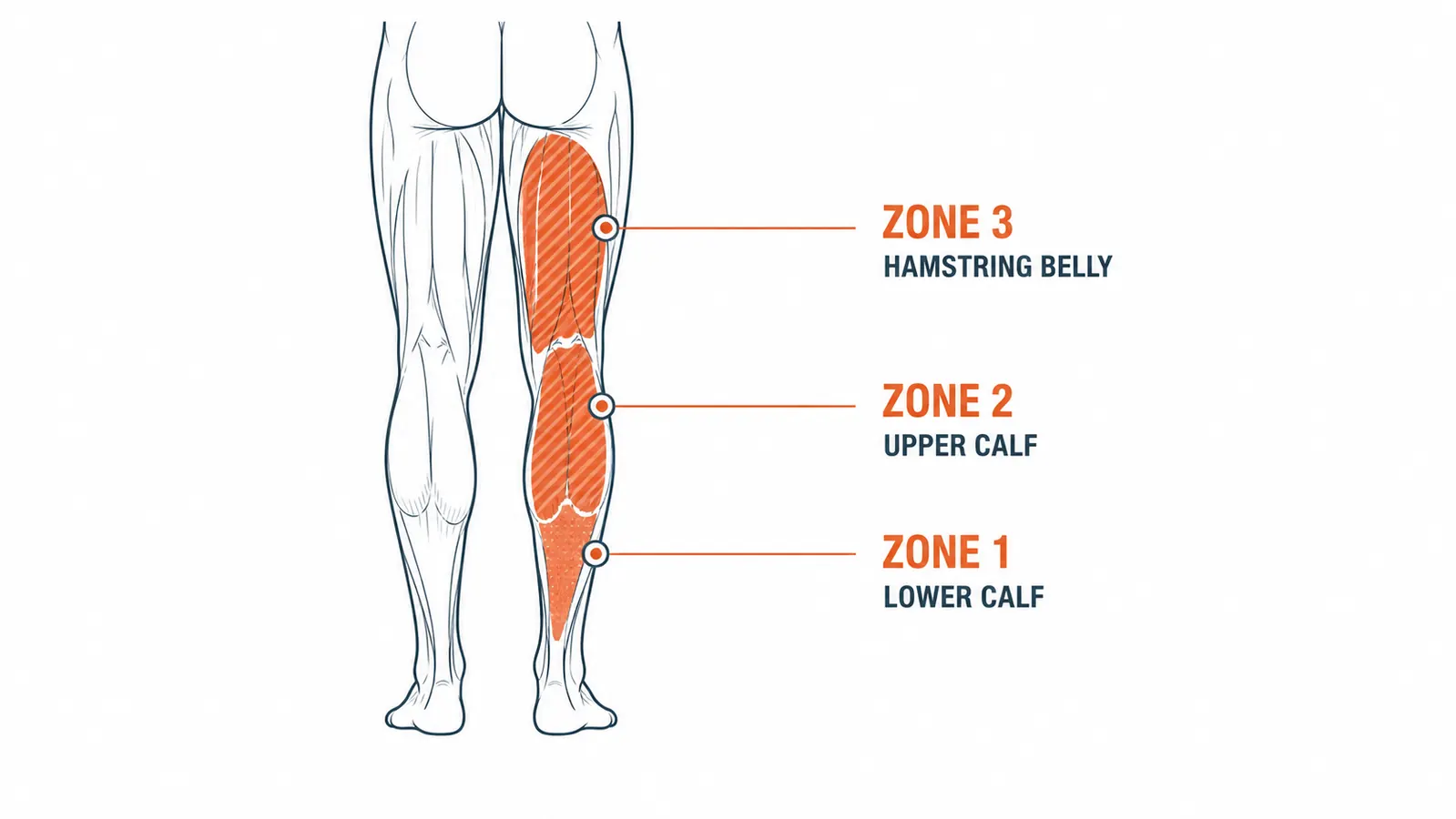 Diagram showing three rolling zones on the back of the leg from calf to hamstring